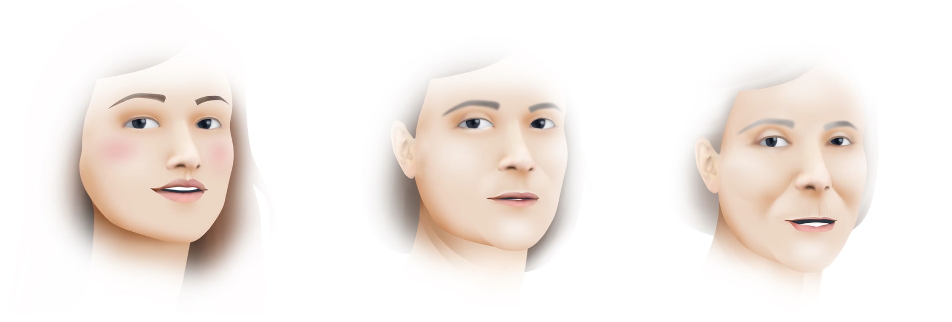 Allongement de la lèvre supérieure avec l'âge