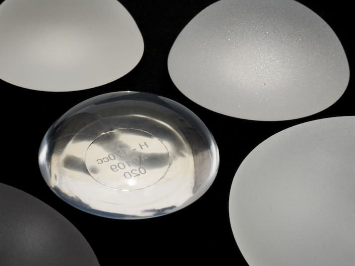 Implants mammaires ronds, lisses ou texturés
